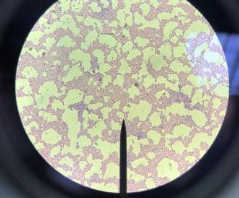 Vista microscopica de las colonias bacterianas aisladas de los ejemplares, Chiroptera: Mimon